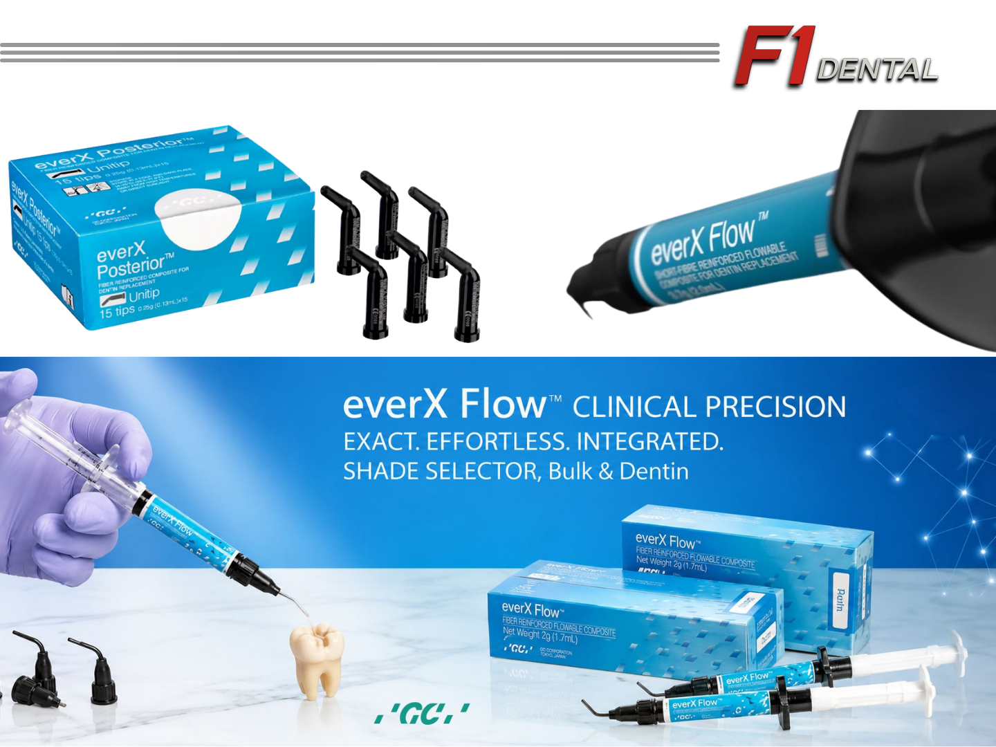 GC everX Flow, fiber destekli kompozit teknolojisi sayesinde posterior restorasyonlarda yüksek kırılma direnci ve uzun dönem klinik başarı sağlar.