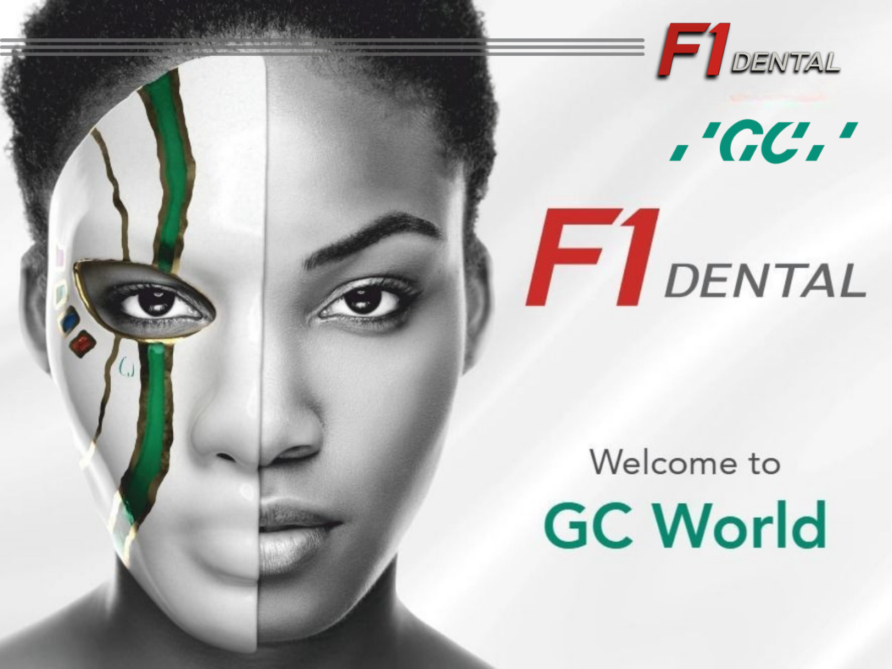 Arka Diş Restorasyonlarında Devrim: Fiber Destekli Kompozit GC everX Flow ve everX Posterior