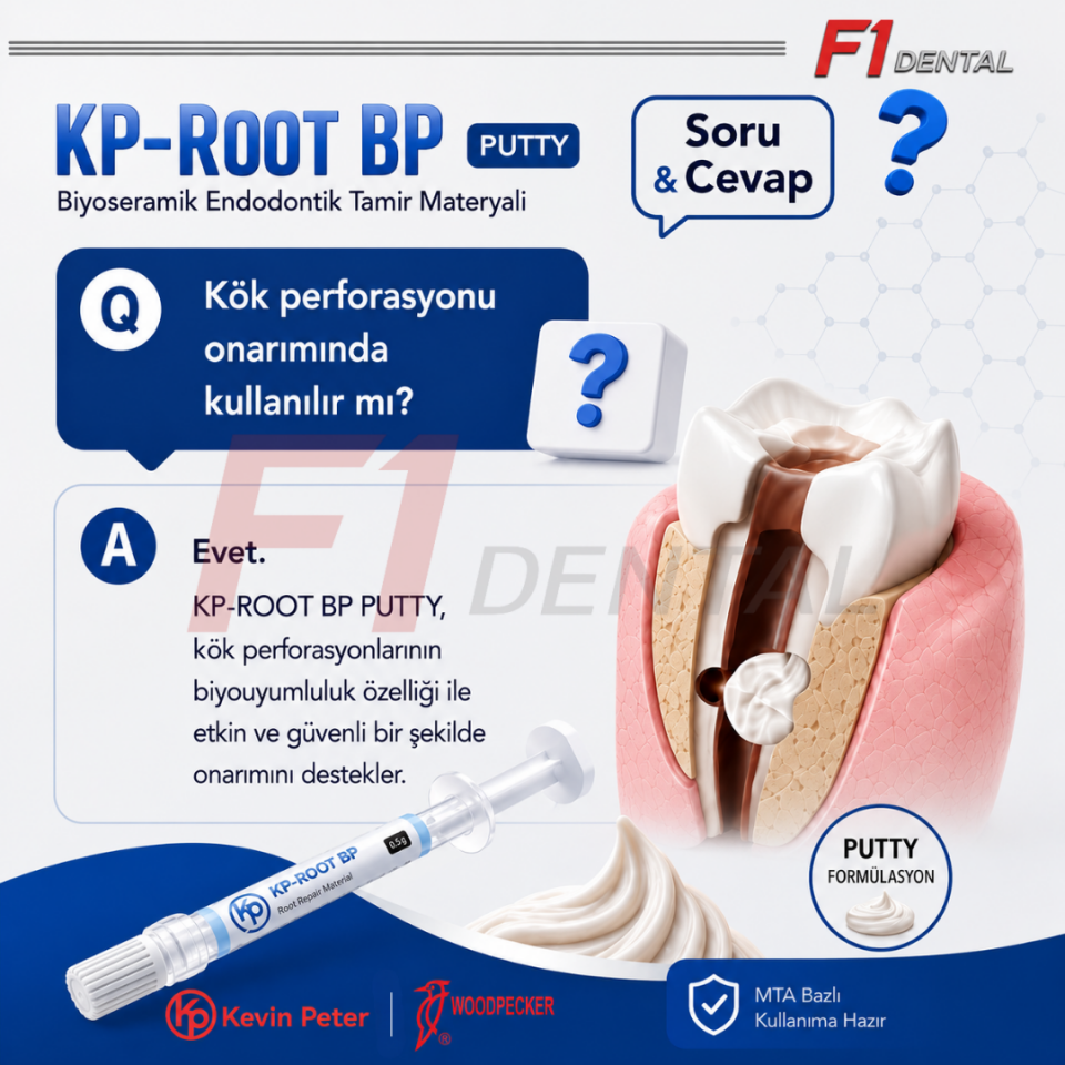 Woodpecker KP-Root BP Biyoseramik Endodontik Tamir Materyali 0.5gr