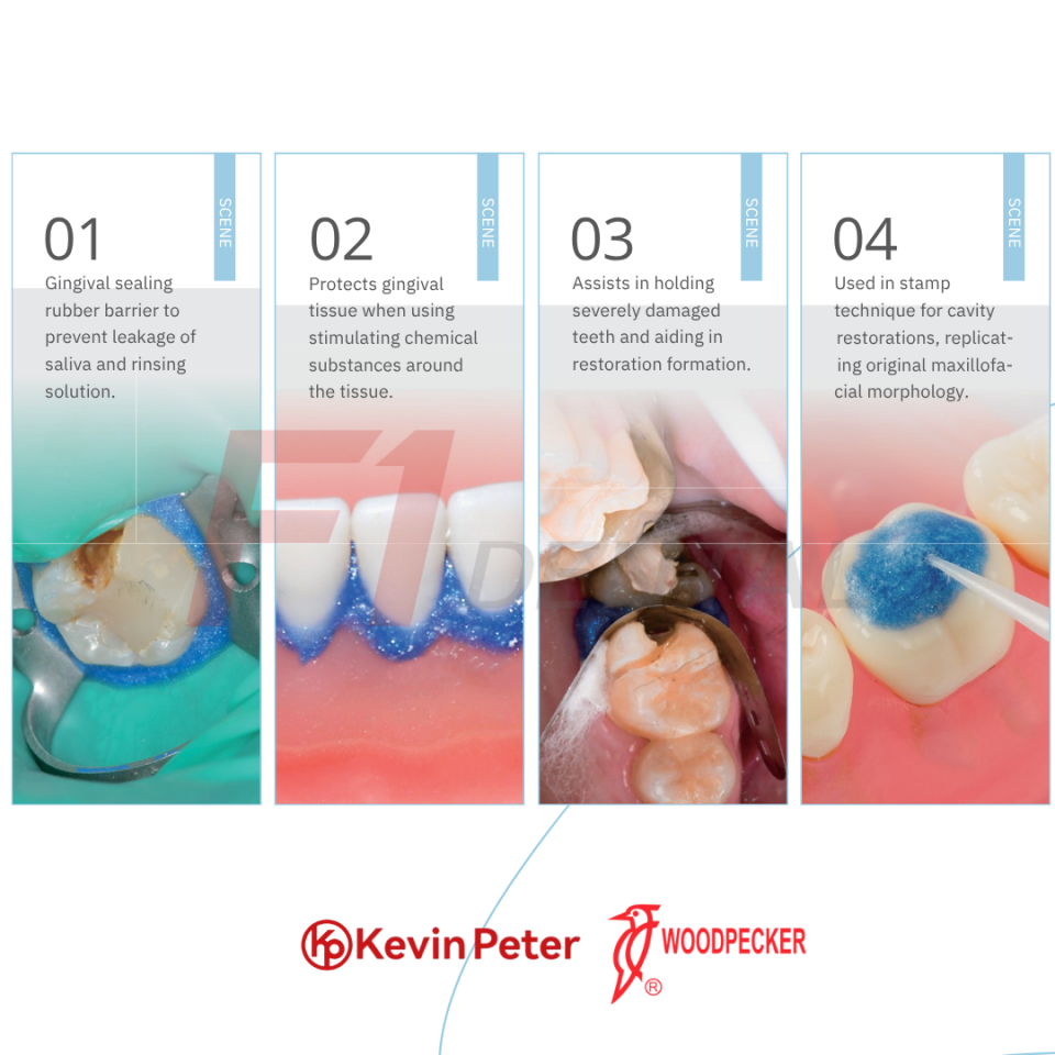 Woodpecker KP-Dam Light Cure Dişeti Koruyucu Bariyer 1.2gr