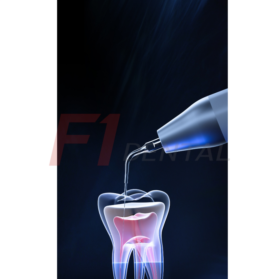 Woodpecker  Kavitron Cihazı U600 LED