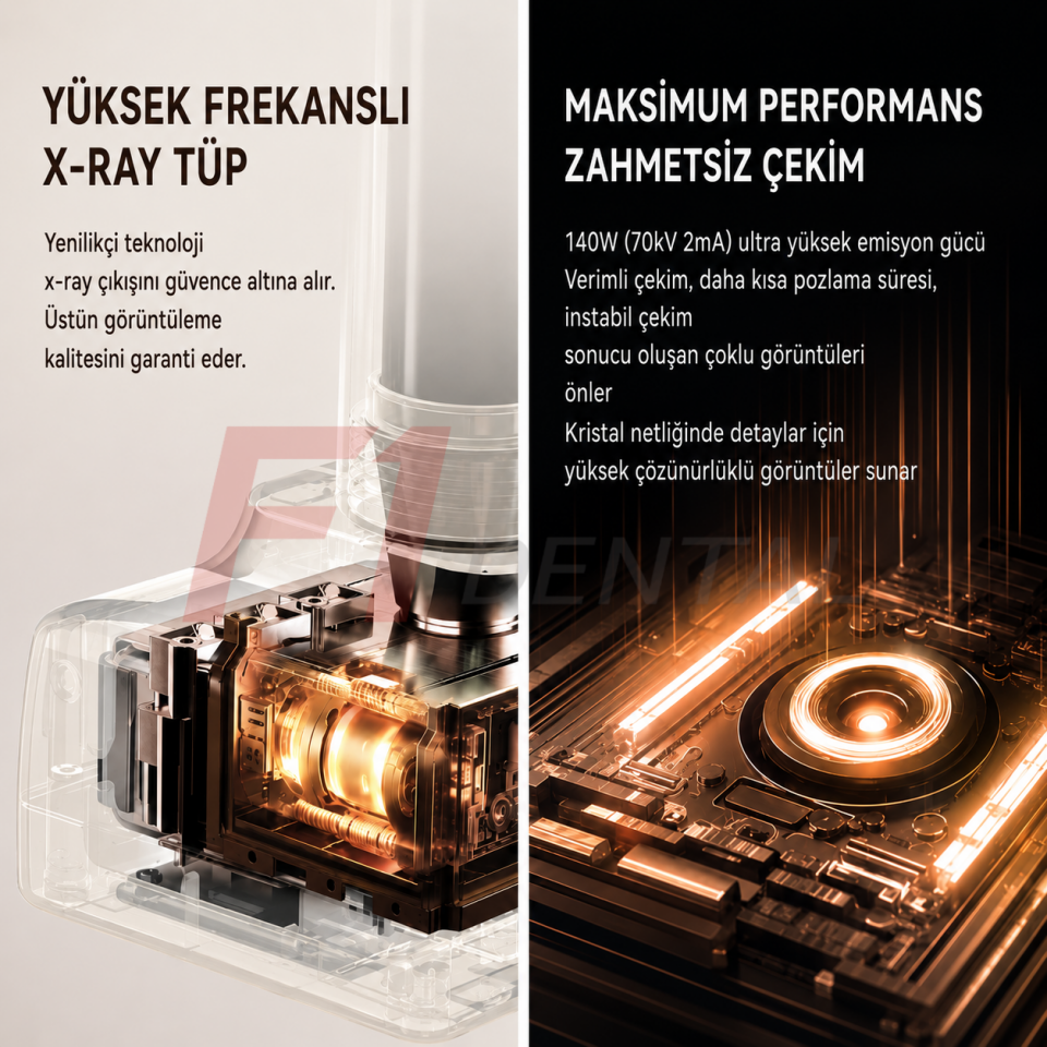 Woodpecker Smart Ray Röntgen Cihazı
