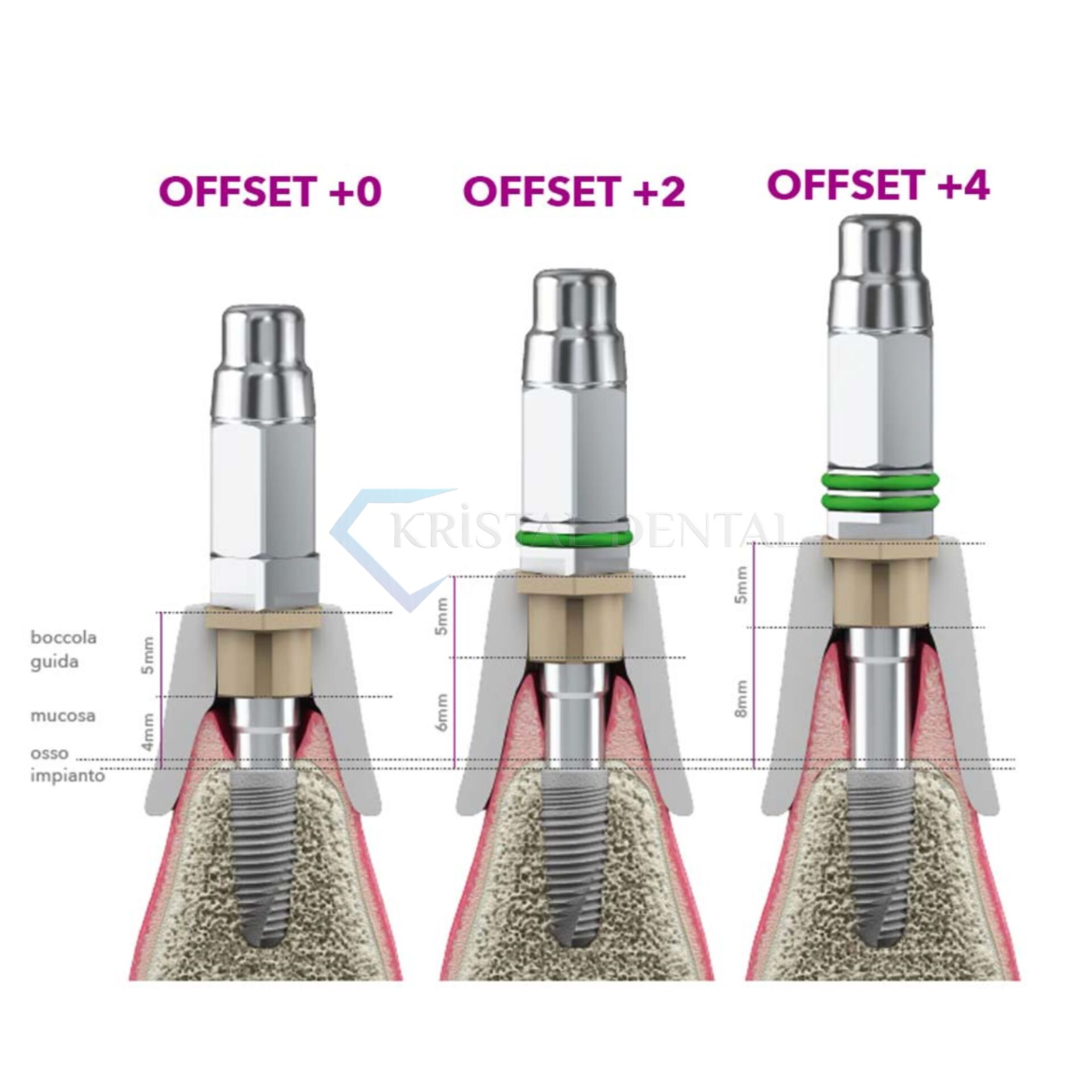 B&B Dental Cerrahi Set +2 +4 Ofset