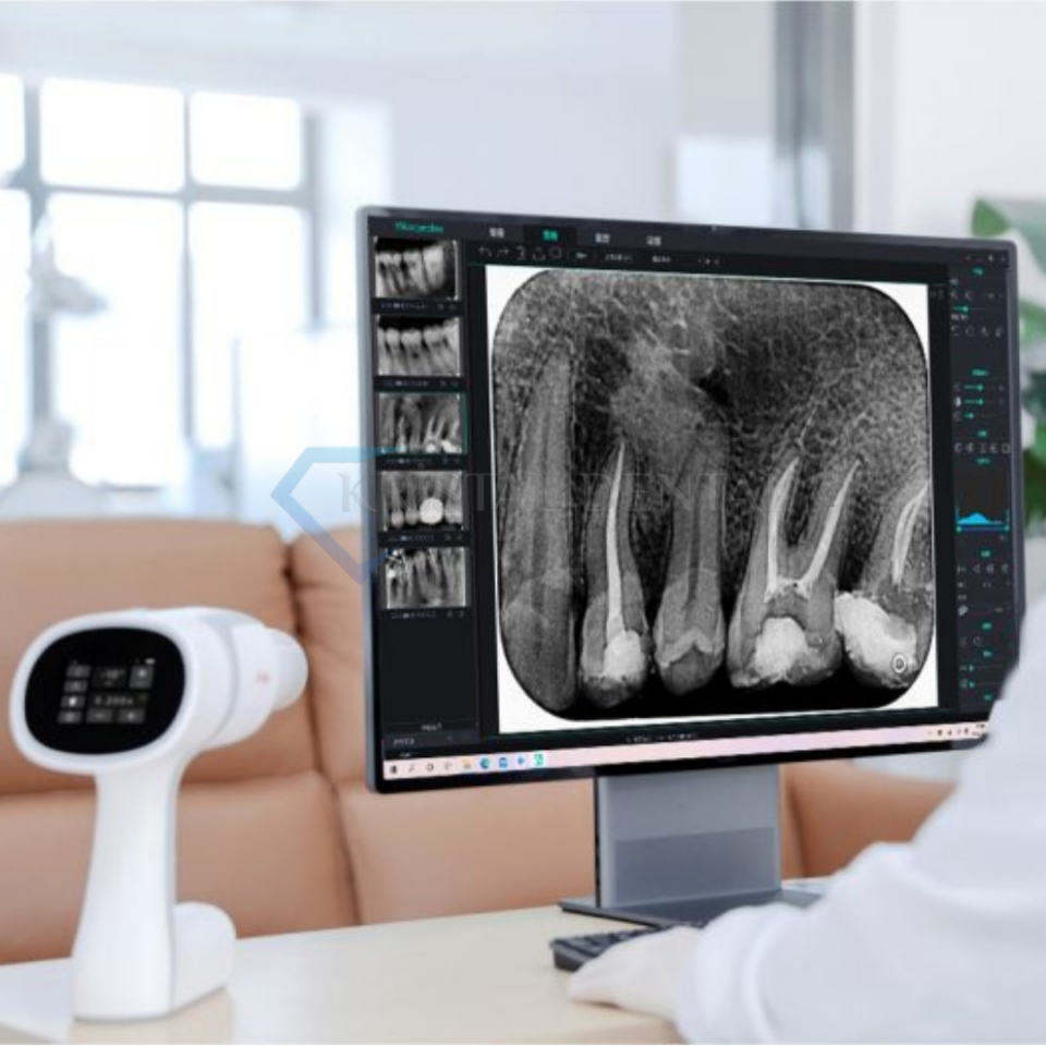 Woodpecker Ai Ray Taşınabilir Röntgen Cihazı