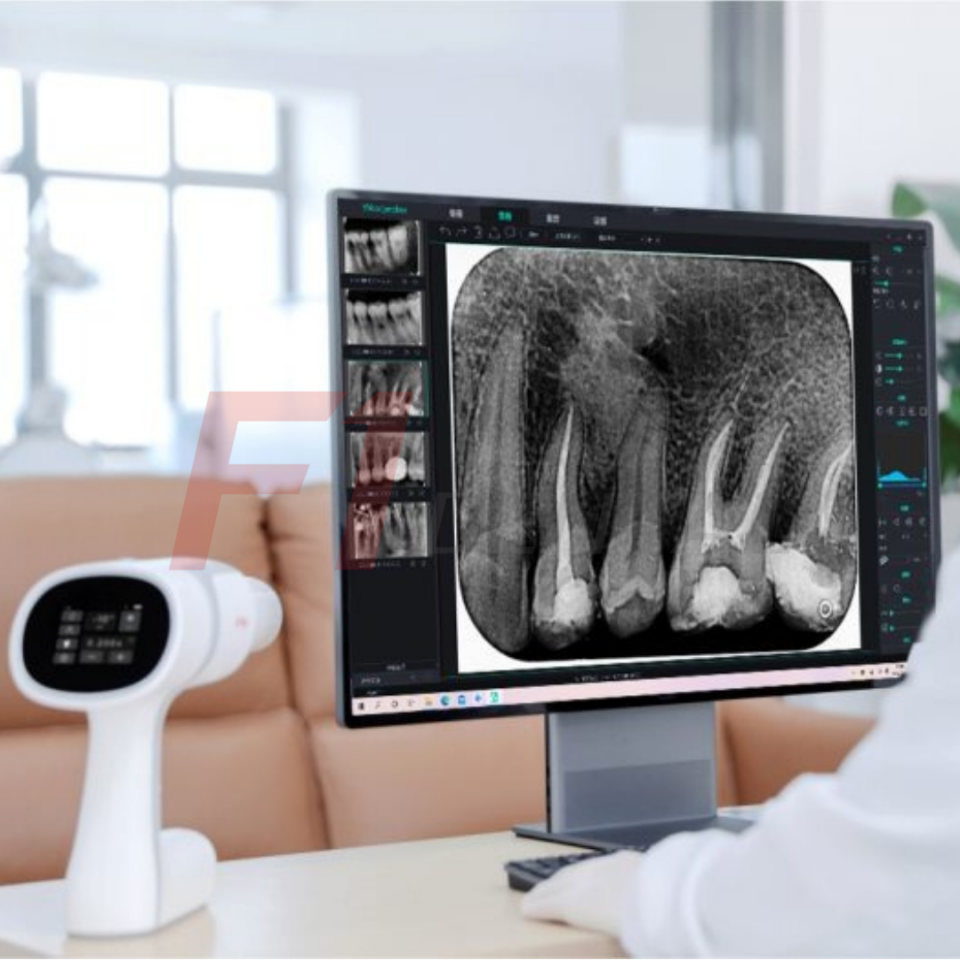 Woodpecker Ai Ray Taşınabilir Röntgen Cihazı