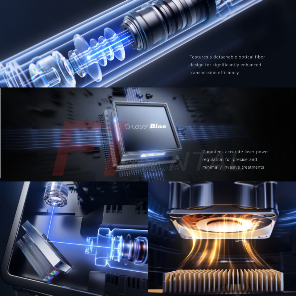 Woodpecker DTE D-Laser Diode Lazer Blue Cihazı