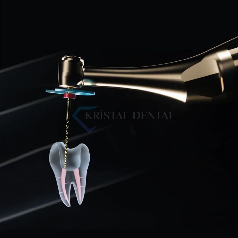 Woodpecker Black Ai-Motor Endomotor ve Apex Bulucu - Black Edition