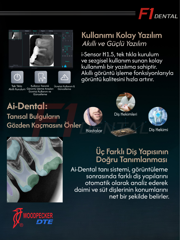 Woodpecker İ-Sensör İntraoral X-Ray Sensörü RVG H1.5