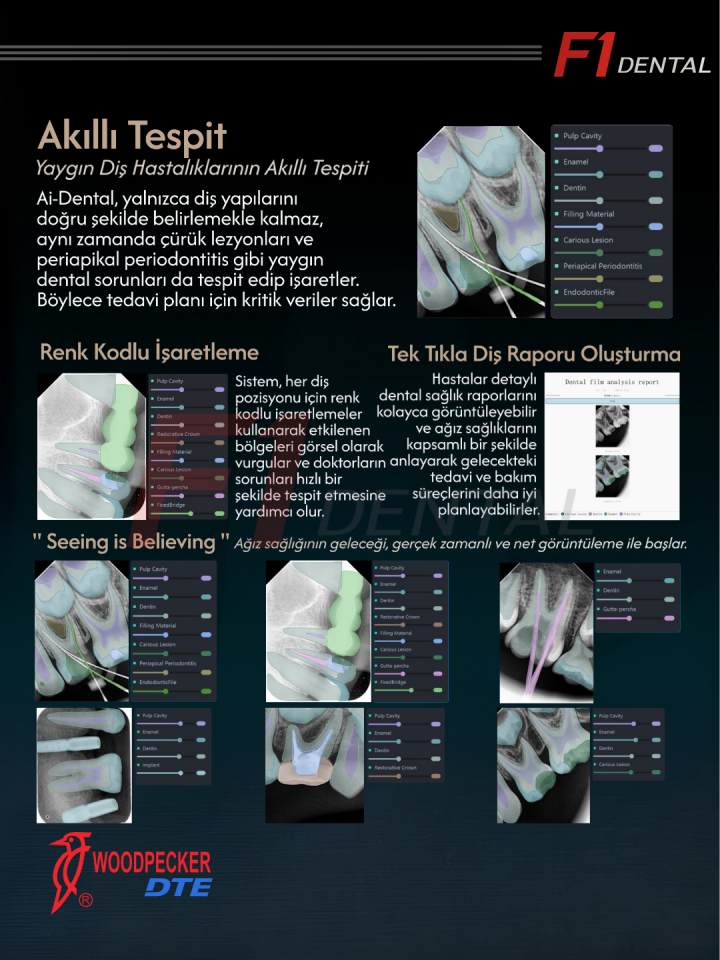 Woodpecker İ-Sensör İntraoral X-Ray Sensörü RVG H1.5