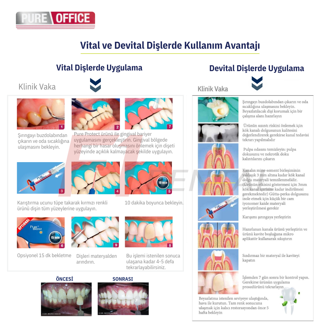 İtena Pure Office Ofis tipi Kök Kanal Value Pack Beyazlatma Seti