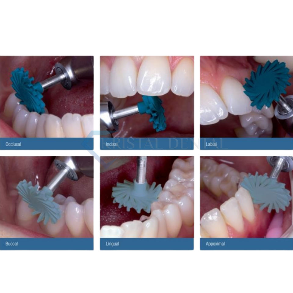 Kuraray Clearfil Twist Dia Kompozit Cila Dİski Trial Kit