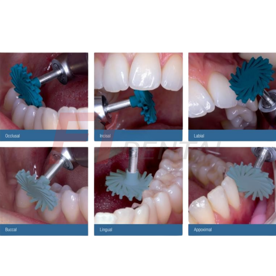 Kuraray Clearfil Twist Dia Kompozit Cila Dİski Trial Kit