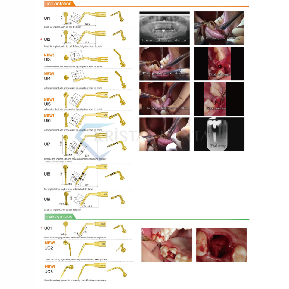 Woodpecker DS-II LED Piezo Cihazı