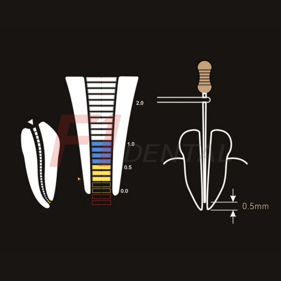 Woodpecker Dpex X Apex Locator
