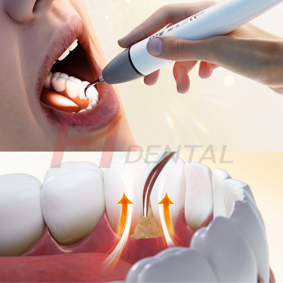 Woodpecker/Dte D8 LED Işıklı Su Hazneli Kavitron