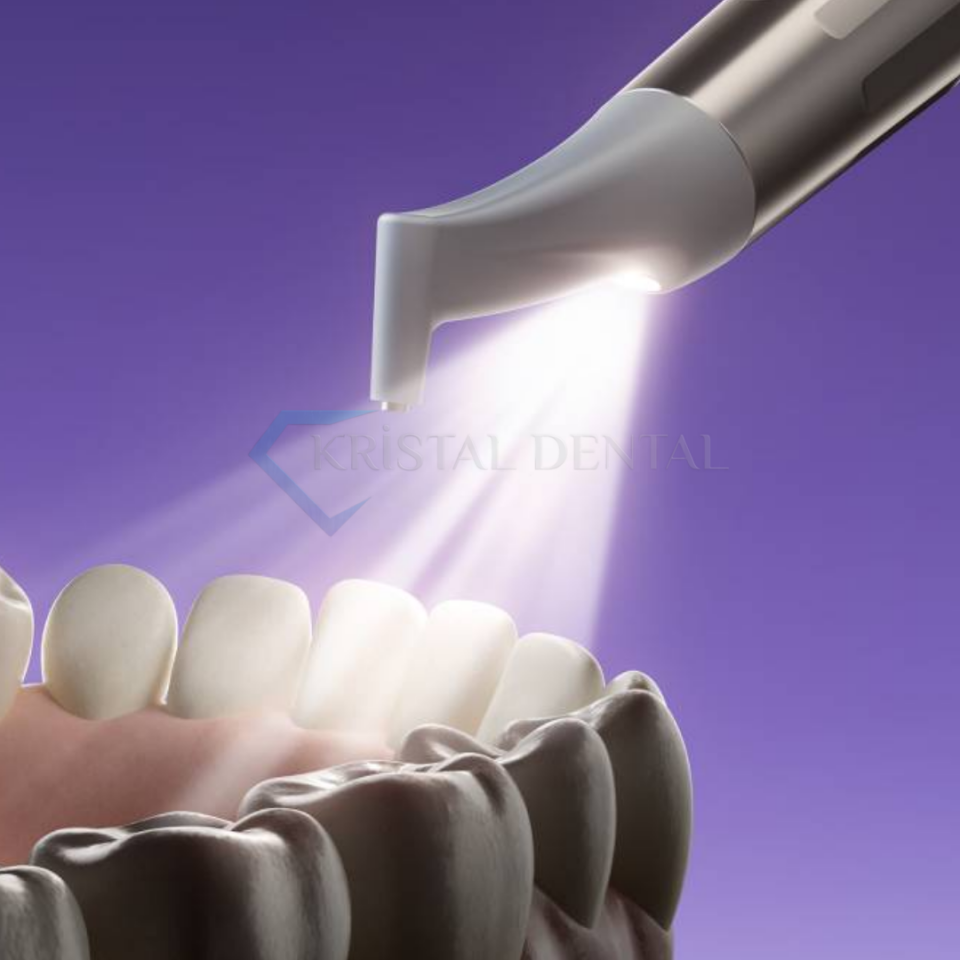 Woodpecker PT-E AirFlow Cihazı