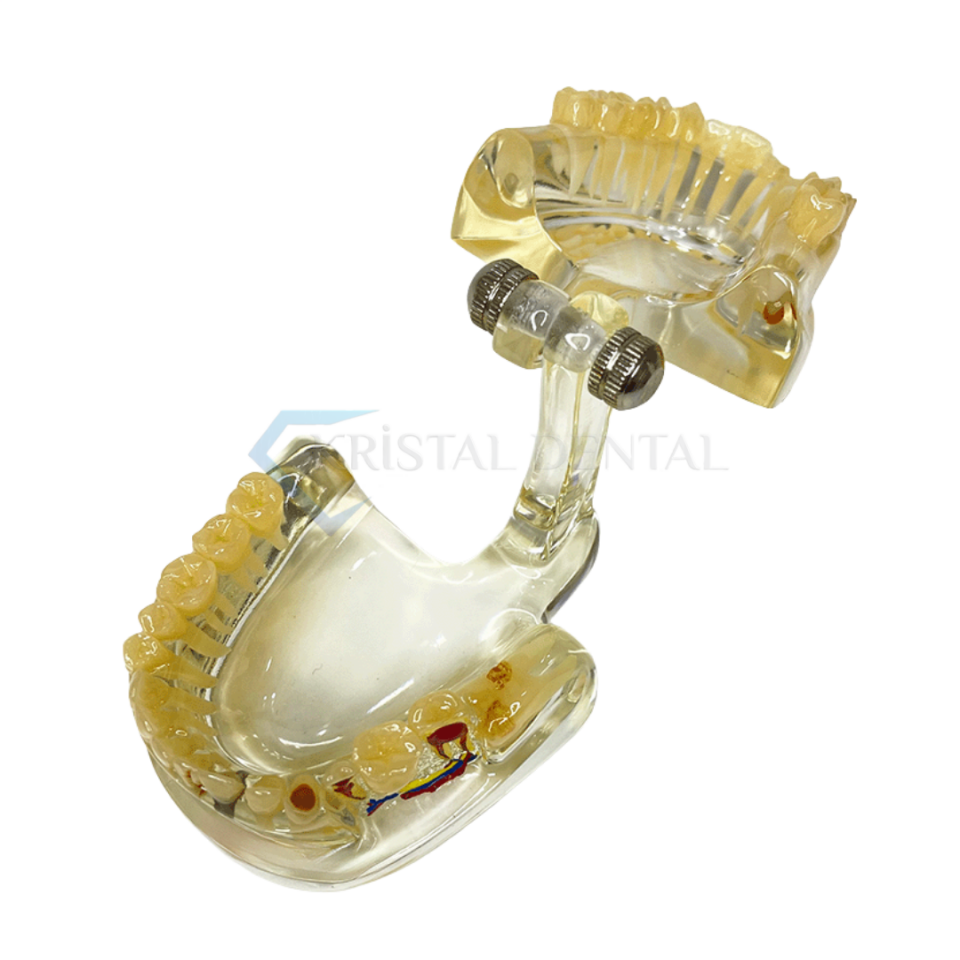 Şeffaf İmplant Model Diş