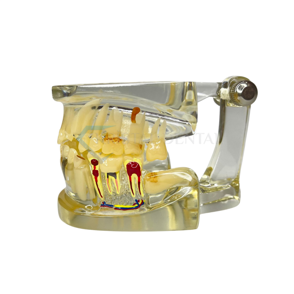 Şeffaf İmplant Model Diş
