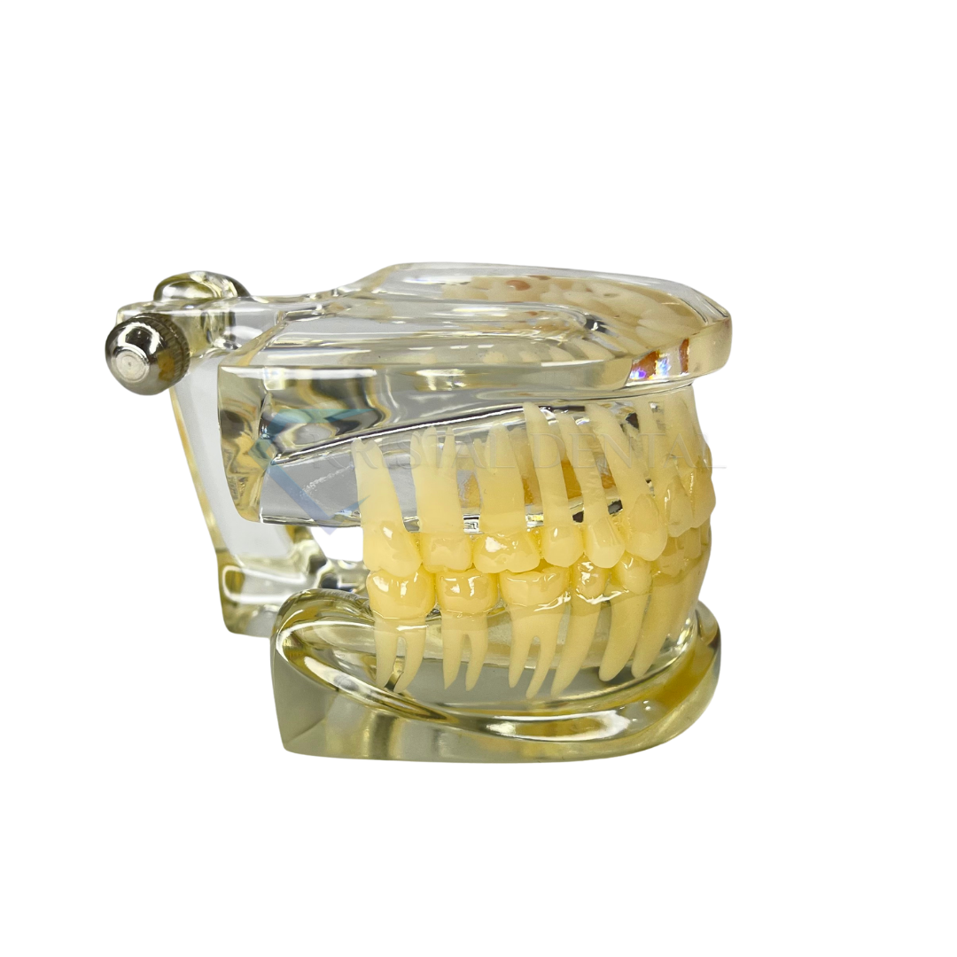 Şeffaf İmplant Model Diş