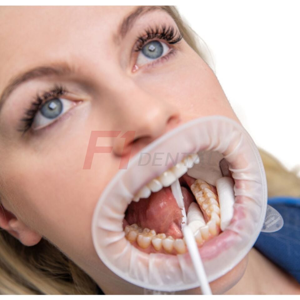 Ivoclar OptraGate Dudak Yanak Ekartörü 40'li