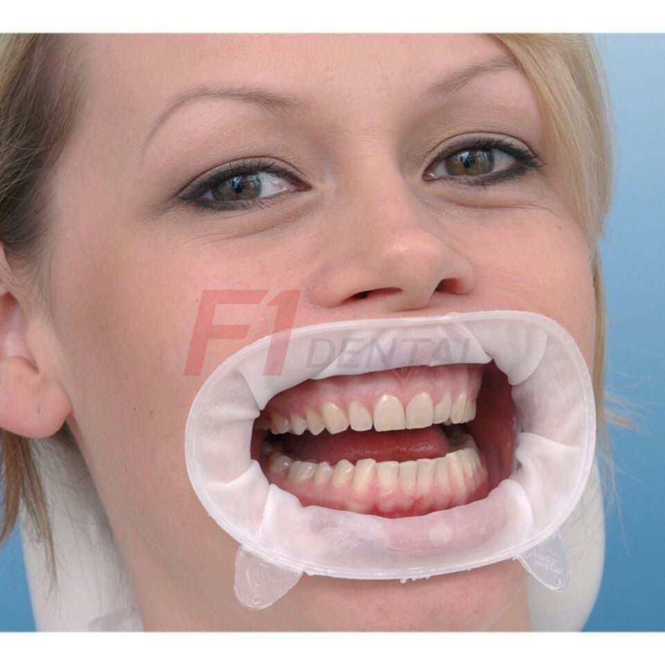 Ivoclar OptraGate Dudak Yanak Ekartörü 40'li