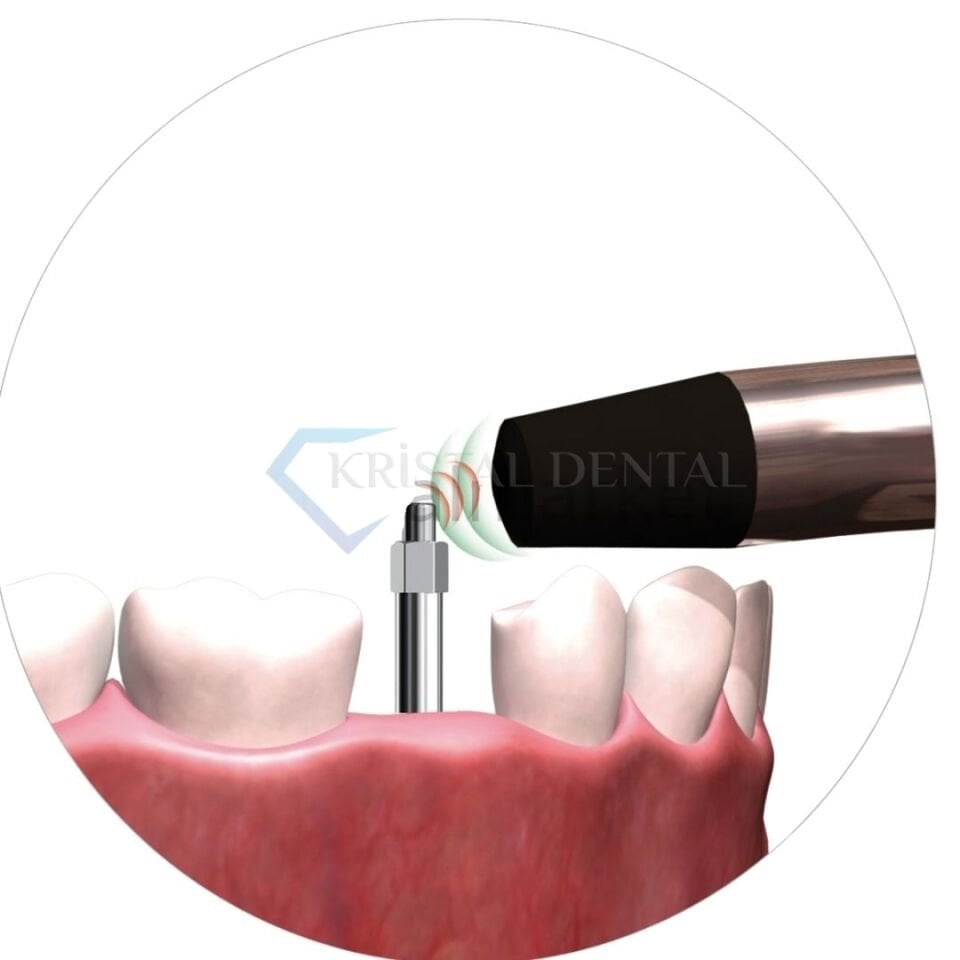 W&H Osstell Smartpegs Osstell Uçları