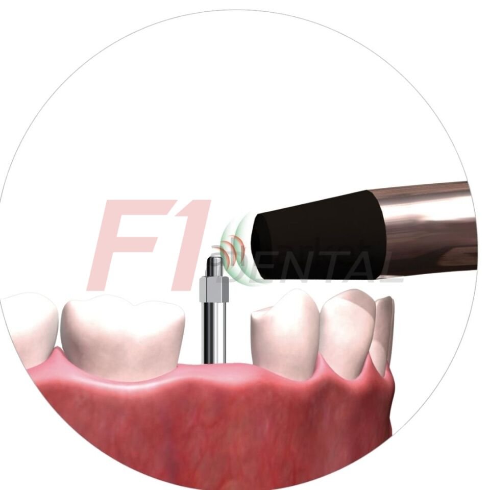 W&H Osstell Smartpegs Osstell Uçları