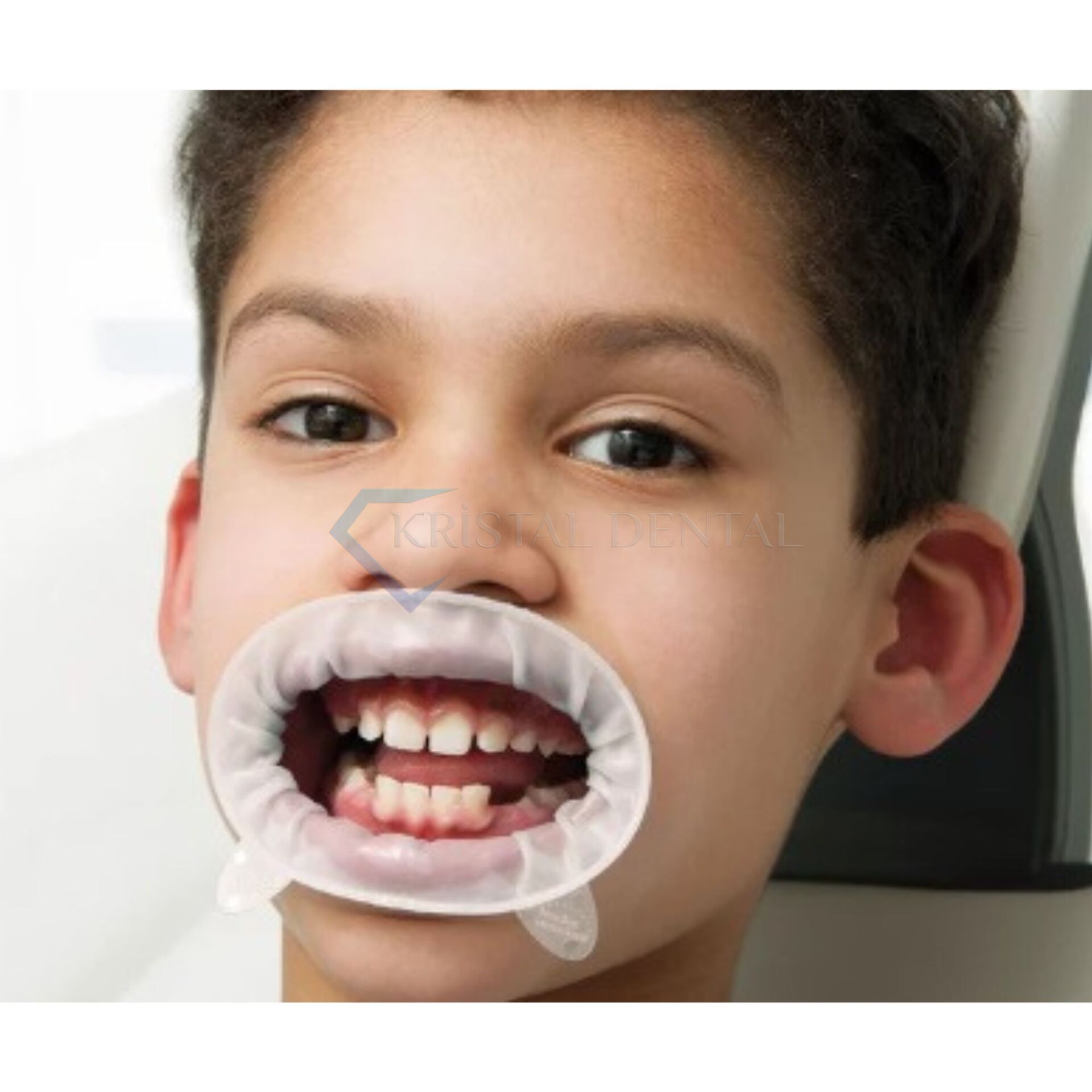 Ivoclar OptraGate Dudak Yanak Ekartörü 40'li Junior