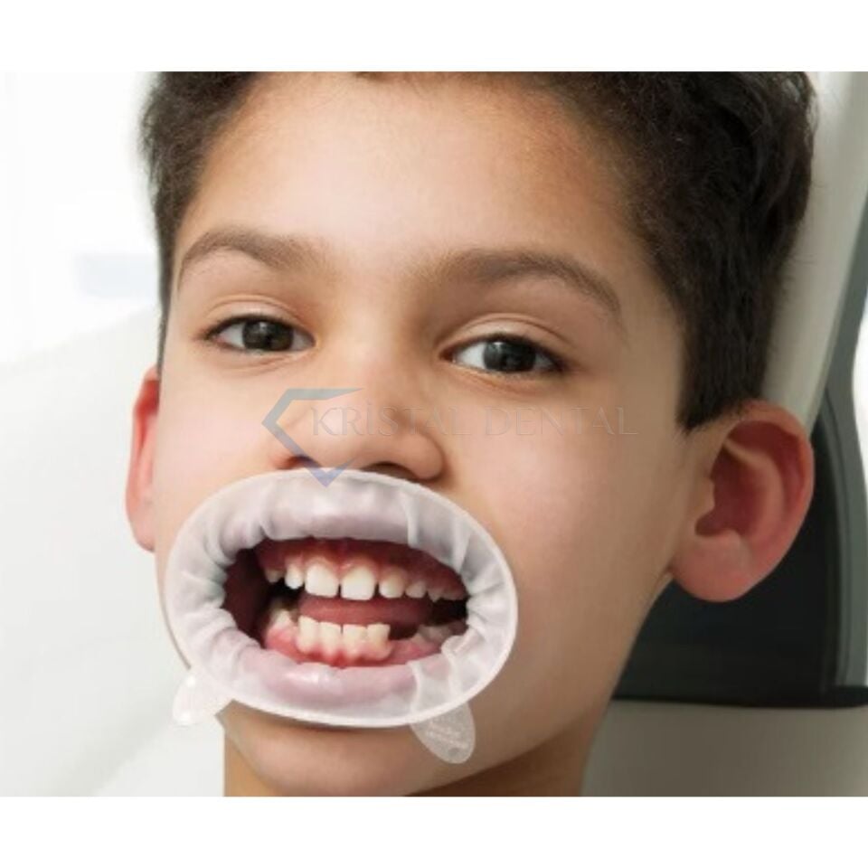 Ivoclar OptraGate Dudak Yanak Ekartörü 40'li Junior