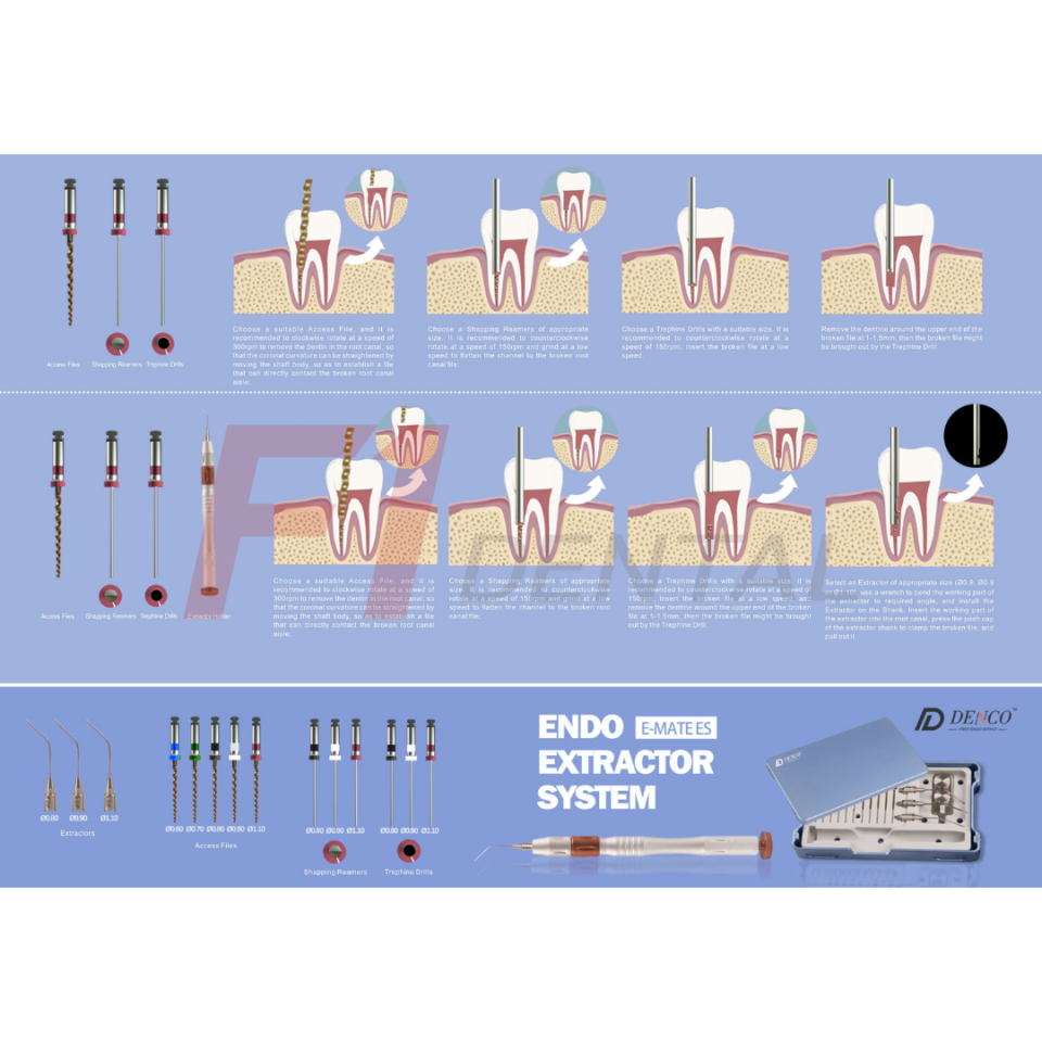 Denco E-Mate Es Endo Extractor / Kırık Eğe Çıkartıcı Sistem