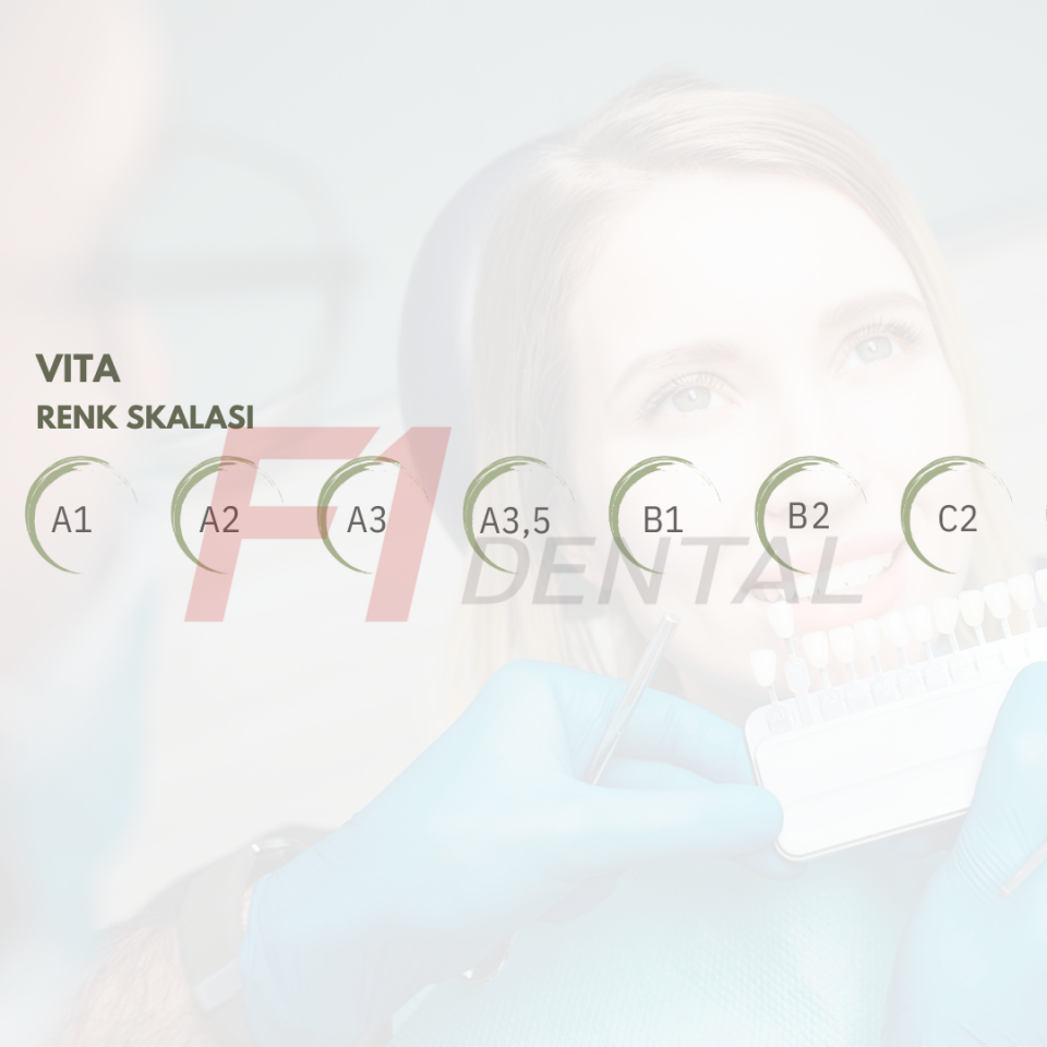 Wp Dental Competence Flow Akışkan Kompozit Refil 1ml