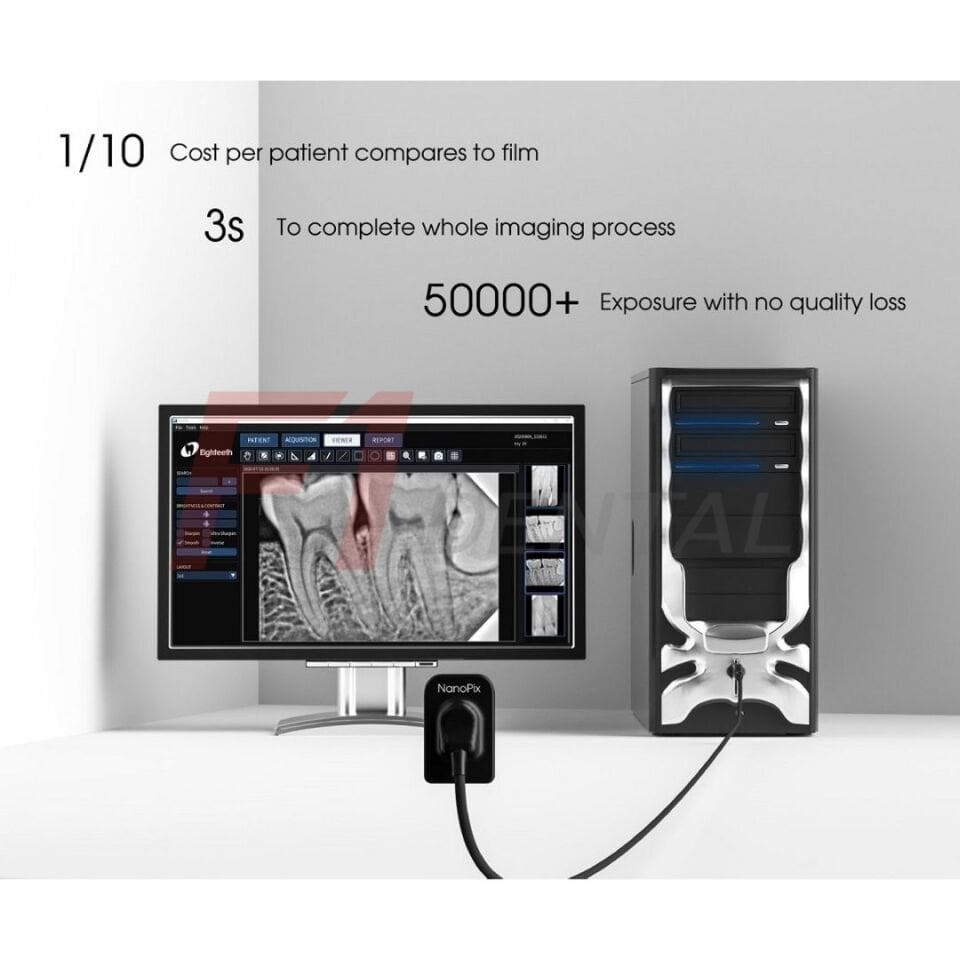Eighteeth Nanopix İntraoral X-Ray Sensörü RVG