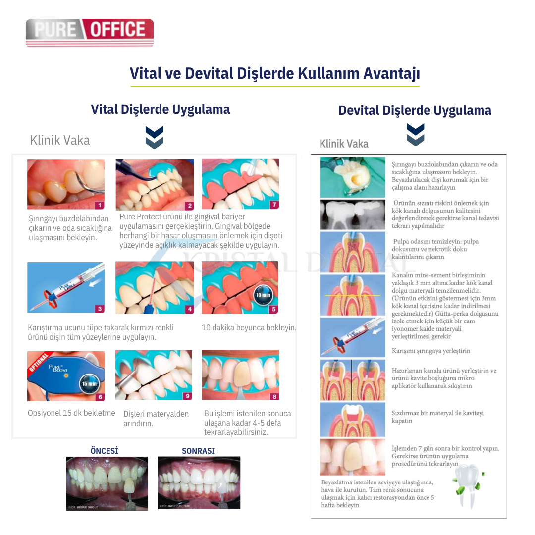 İtena Pure Office Ofis tipi Kök Kanal Başlangıç Beyazlatma Seti