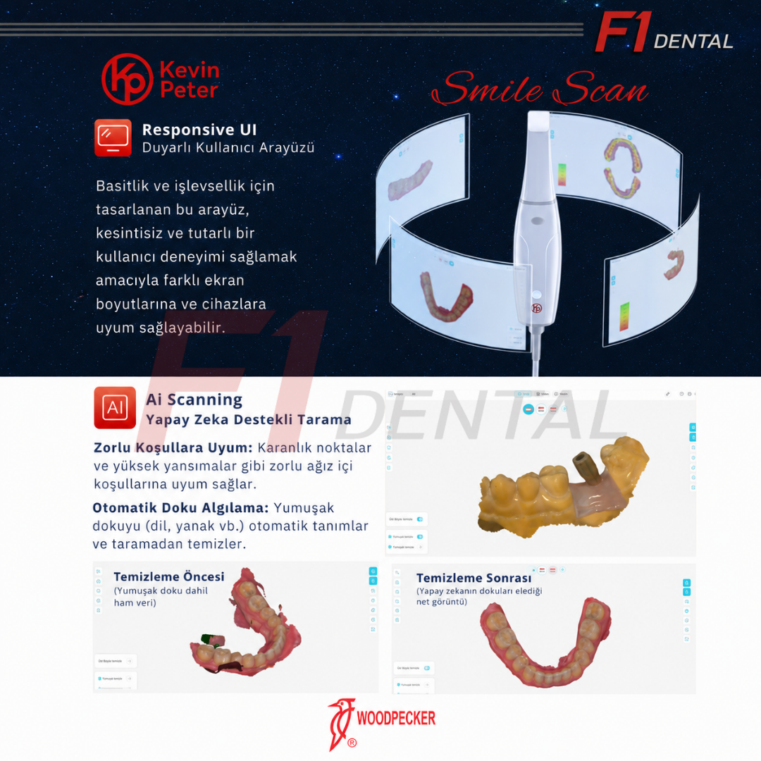 Woodpecker Smile Scan - Ağız İçi Tarayıcı Cihazı