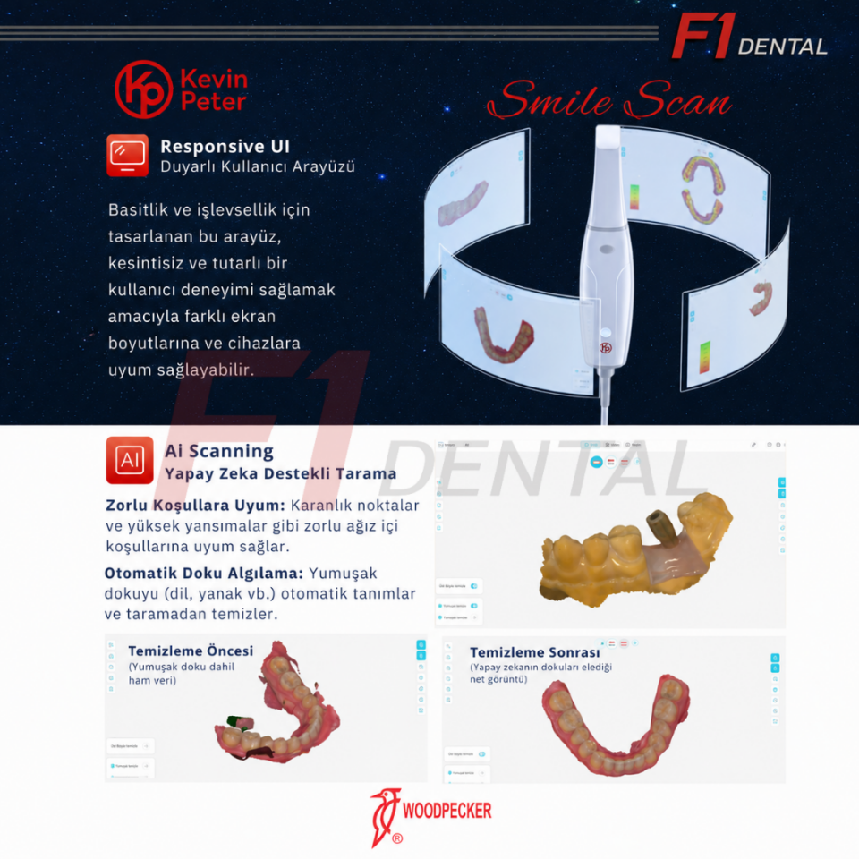 Woodpecker Smile Scan - Ağız İçi Tarayıcı Cihazı